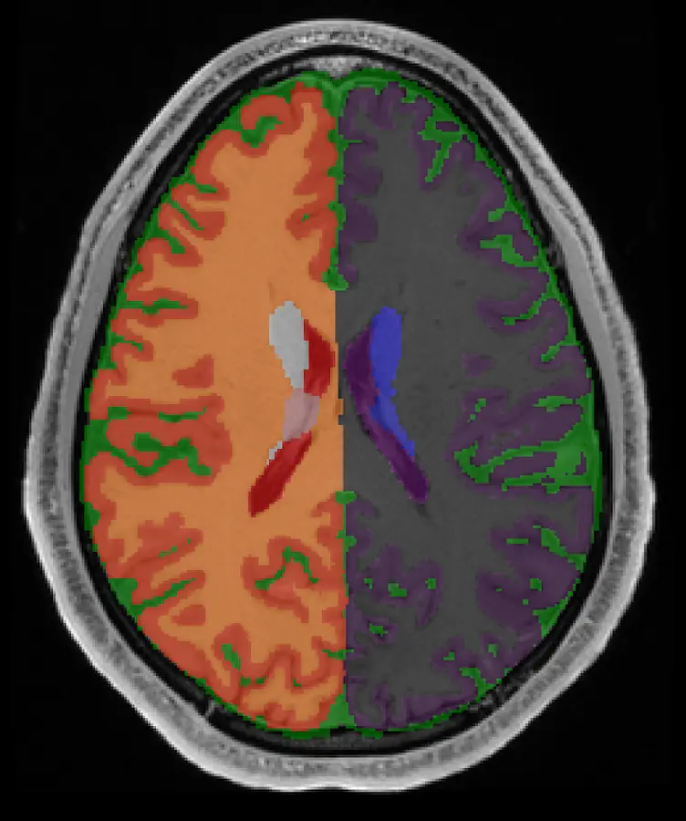 Medical image segmentation visualization with anatomical regions highlighted