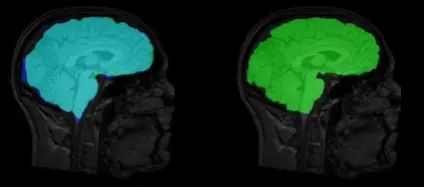 Brain extraction examples showing source images, predictions, and reference masks